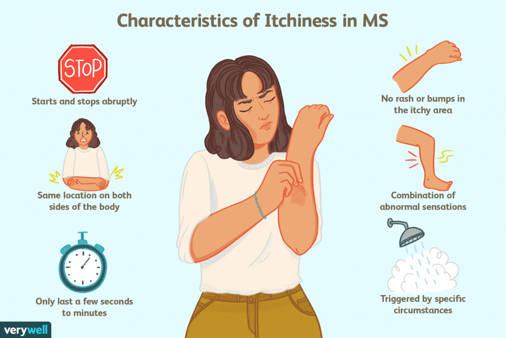 ms symptoms in women
