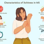 ms symptoms in women